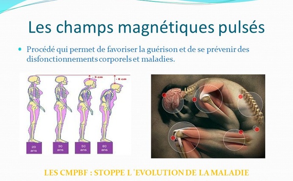 La magnétothérapie pulsée : une approche innovante pour le bien-être 🌟